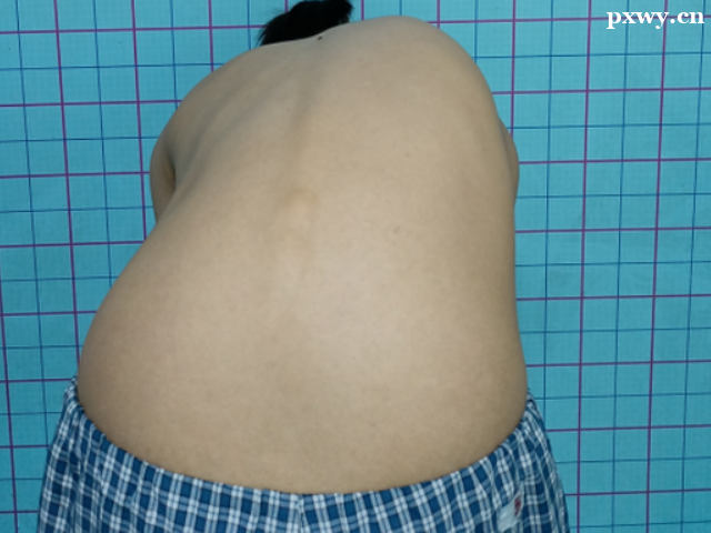 ������(c��)�������ڰY����F(xi��n)����Щ